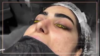 فیلم واقعی جراحی بینی