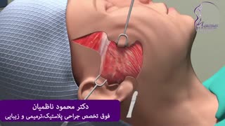فیلم جراحی لیفت صورت لیفت گردنایمپلنت دندان