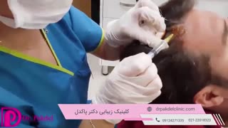 مزوتراپی چیست و چه کاربردهایی دارد؟