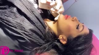 تزریق ژل چانه
