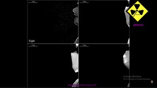 تاثیر ماسک سه لایه جراحی در جلوگیری از انتقال و سرایت بیماری های ویروسی