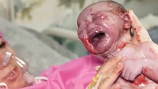 زایمان طبیعی بدون درد