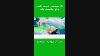 عمل آب مروارید(کاتاراکت)
