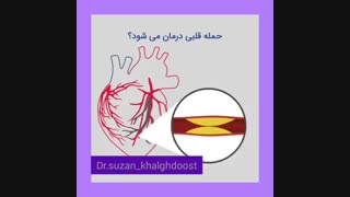حمله قلبی و درمان آن