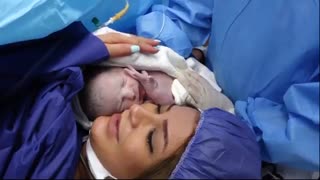 زایمان سزارین توسط دکتر حاجیها