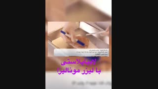 لابیاپلاستی با لیزر مونالیزا تاچ