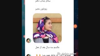 3 سال بعد از جراحی بینی
