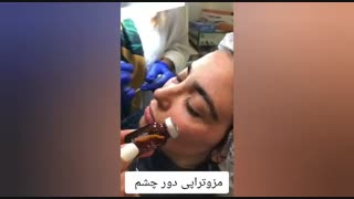 فیلم واقعی مزوتراپی دور چشم