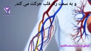 انیمیشنی درباره گرفتگی رگ قلب و استنت گذاری