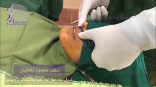 جراحی لیفت لب تحت بی حسی موضعی