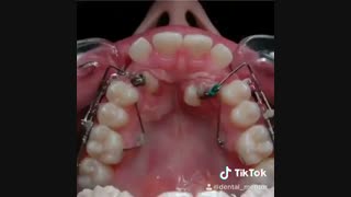 ارتودنسی دندان مشهد