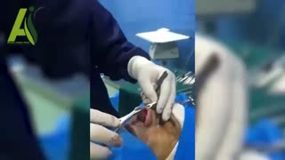 فیلم عمل بینی توسط جراح فوق تخصص پلاستیک، دکتر علی اکبر عطایی