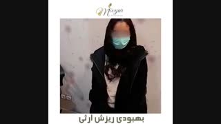 بهبودی ریزش مو ارثی بیمار عزیزمون