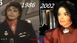 عمل های جراحی مایکل جکسون