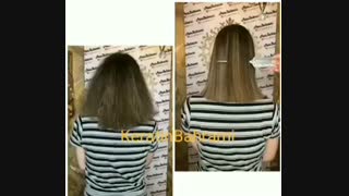 اوزون تراپی