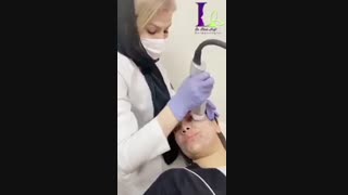 جوانسازی صورت با آر اف