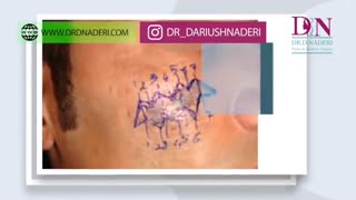 ترمیم اسکار زیبایی پوست