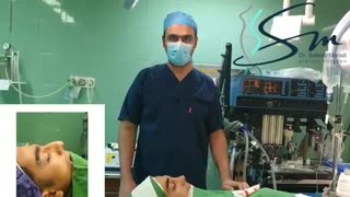 فیلم  قبل و بلافاصله بعد از پایان جراحی بینی