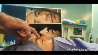 فیلم اصلاح کجی بینی گوشتی