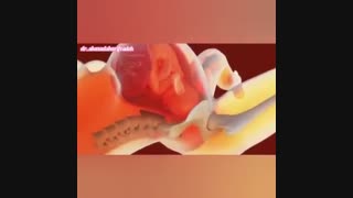 انیمیشن شیوه قرارگیری جنین برای زایمان طبیعی