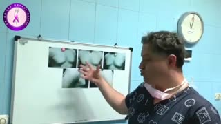 اصلاح ژنیکوماستی شدید