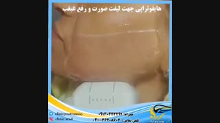 جوانسازی صورت و گردن دندانپزشکی کودکان