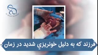 فیبروم رحم