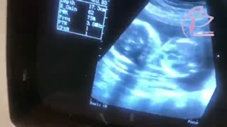 زیباترین تپش قلب