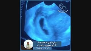 تعیین جنسیت
