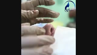 جراحی زیبایی بینی