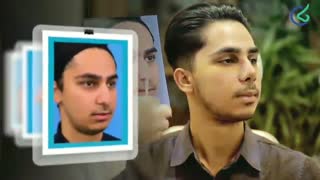 فیلم عمل بینی گوشتی مردانه توسط دکتر سید علی بصام