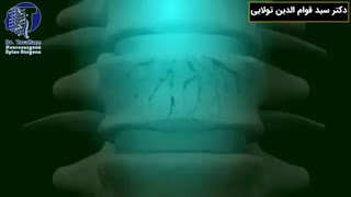 درمان درد کمر