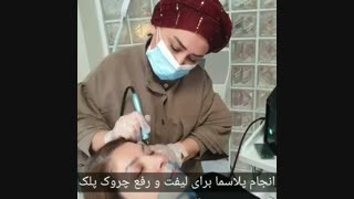 لیفت پلک بدون جراحی