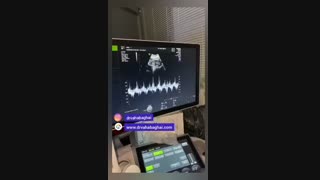 نکات مهم در مورد سونوگرافی بارداری