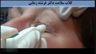 هیچ پلاسمایی، پلکسر نیست