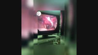 عمل لاپاراسکوپی حاملگی خارج کردن رحم