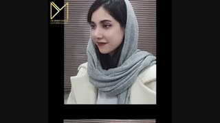 حدود یک ماه پس از جراحی زیبایی بینی به سبک نچرال استتیک(یعنی متناسب با صورتتون)