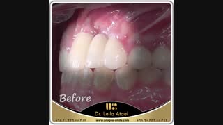 شما آخرین باری که از ته دل و با دهان باز خندیدین کی بوده؟؟؟ | دکتر لیلا عطایی