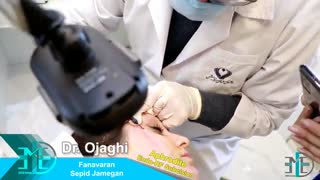 دستگاه Aphrodite