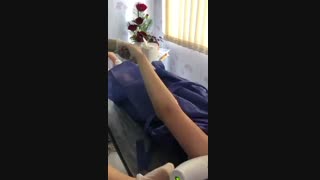 لیزر موهای زائد بر روی دست ها