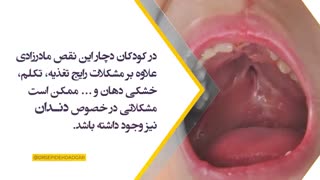 شکاف لب و کام | دگتر سپیده دادگر