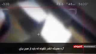 سبقت بی سابقه جراحی های زیبایی  حتی در دوران کرونا!!؟؟؟!