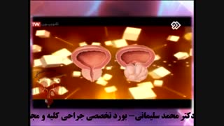 توضیحات دکتر محمد سلیمانی در خصوص بزرگی خوشخیم پروستات - قسمت اول لیپوساکشن
