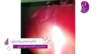 فیلم واقعی جراحی سنگ حالب