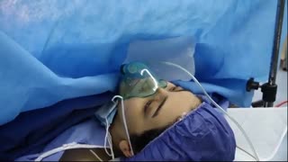 عمل زایمان سزارین