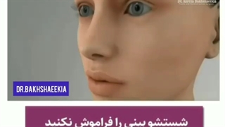 انیمیشن مراقبت های بعد از جراحی بینی