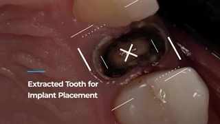 دکتر محمد سعید ساغری کربوکسی تراپی