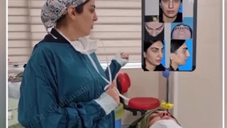 دکتر شادی جوادی بلیچینگ دندان