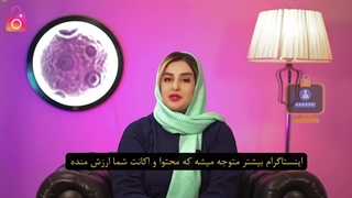 خرید بازدید پروفایل اینستاگرام ارزان و با کیفیت (تحویل فوری)