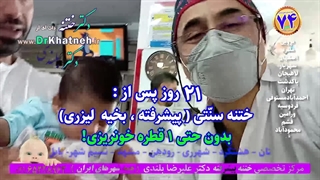 فیلم ختنه بدون درد